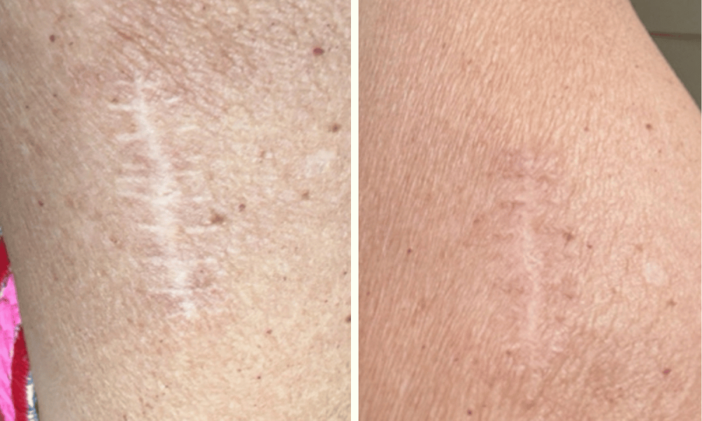 before-after